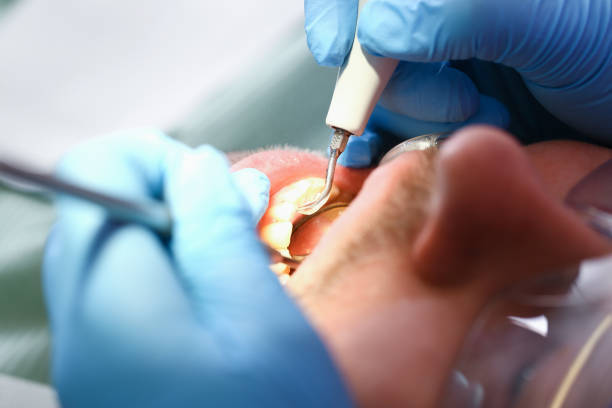 Best Emergency Gum Pain Relief  in Marksville, LA