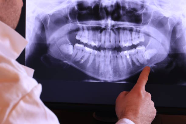 Best Cracked Tooth Emergency Dentist  in Marksville, LA