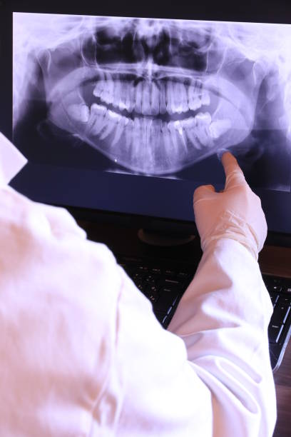 Best Knocked-Out Tooth Emergency  in Marksville, LA