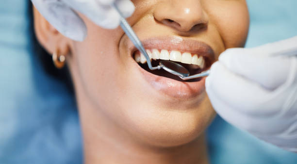 Best Tooth Pain Emergency Relief  in Marksville, LA