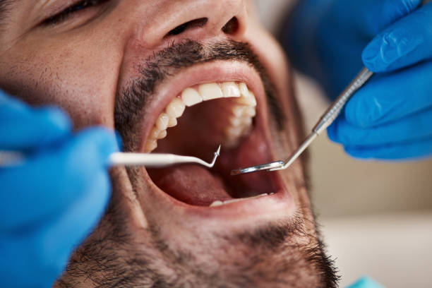 Best Tooth Infection Emergency Dentist  in Marksville, LA